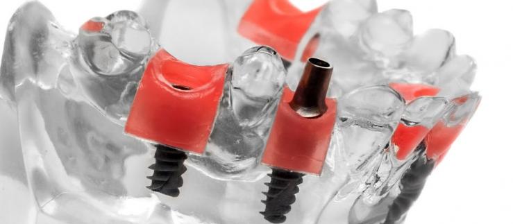 Polish dental market relies high quality