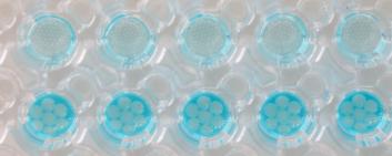 Standardizing organoid growth through controlled guidance systems
